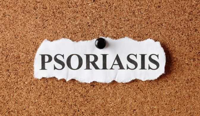 Методы лечения псориаза